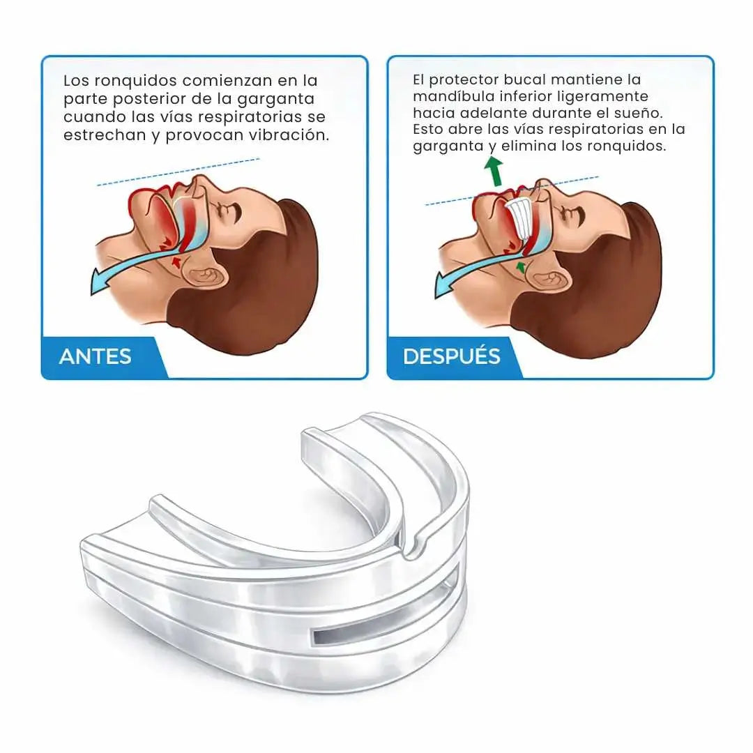 SleepGuard | Protector Bucal Nocturno contra Ronquidos y Bruxismo 🦷