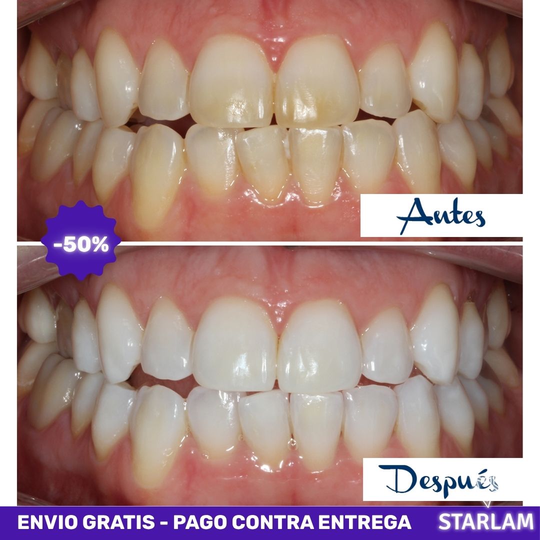3DWhite | Tiras blanqueadoras tratamiento de 7 días para una sonrisa blanca