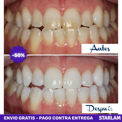 3DWhite | Tiras blanqueadoras tratamiento de 7 días para una sonrisa blanca