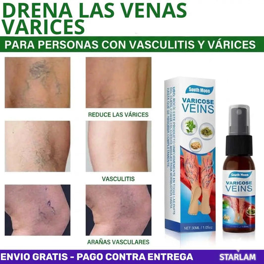 Promo x2 | Recupérate de las venas varices con este spray