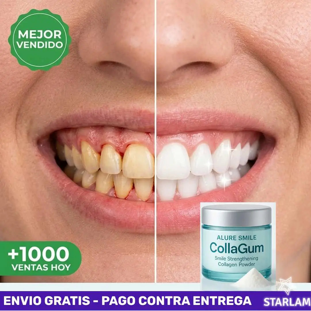 AlureSmile™ | Cuidado Oral  Detiene la pérdida de encía desde el primer uso