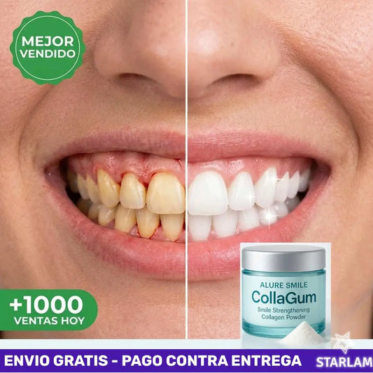 AlureSmile™ | Cuidado Oral  Detiene la pérdida de encía desde el primer uso