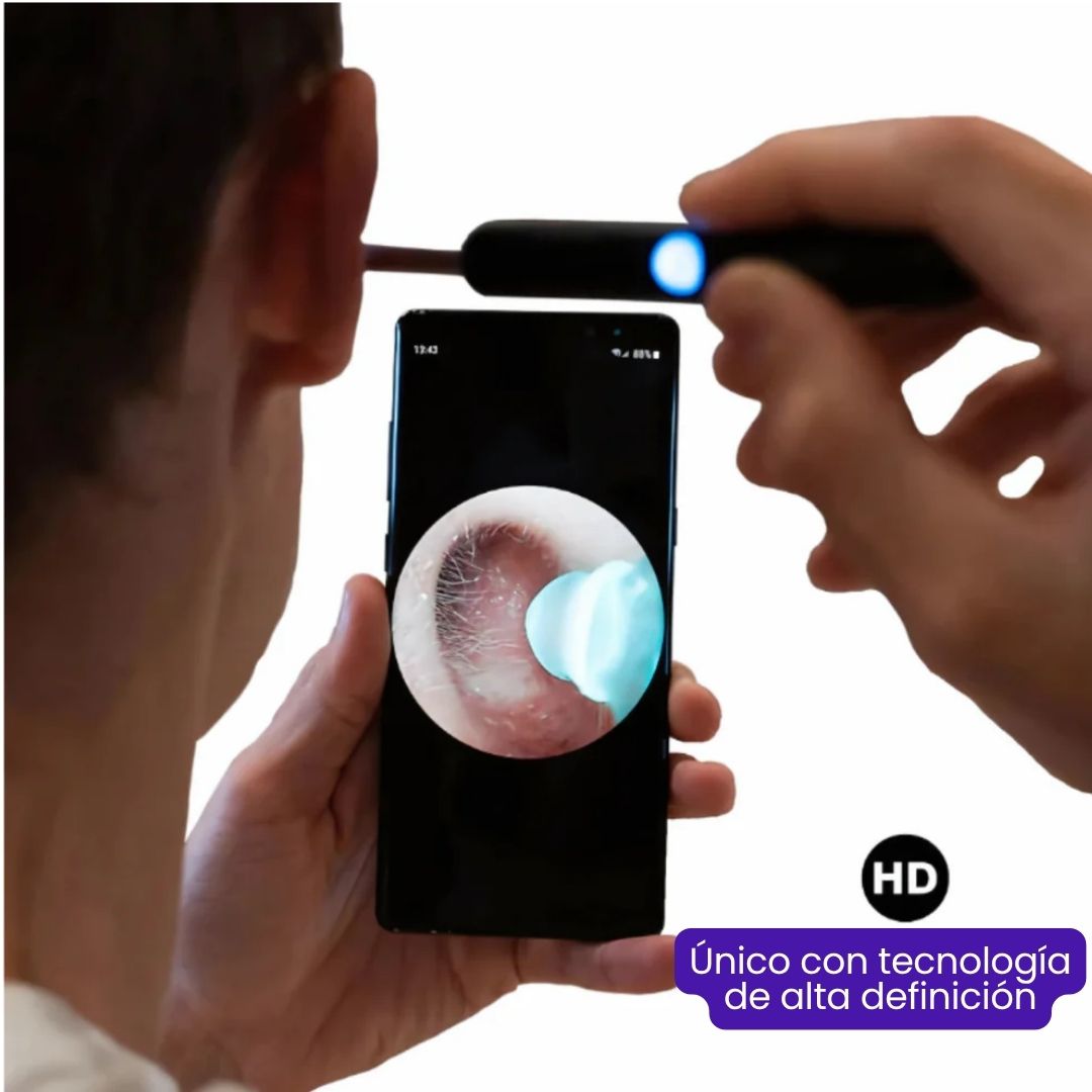 WaxKlean | Limpiador De Oídos Con Cámara remueve cera y mugre