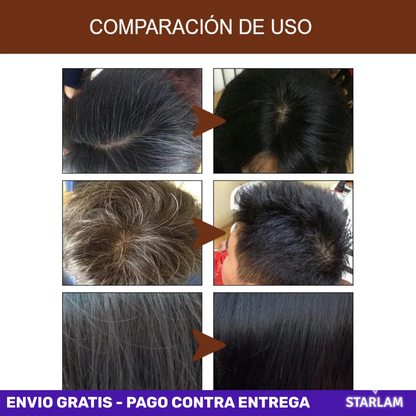 Antigray Shampoo Anti canas 100% natural - Tiñe canas sin químicos desde el día 1