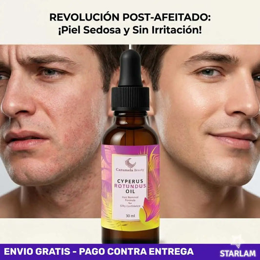 Serum Aceite de Cyperus inhibidor del crecimiento del vello